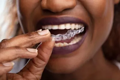 woman putting in her new SureSmile clear aligners